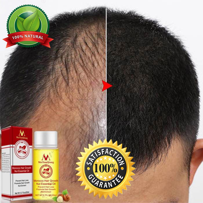 Magical Hair Growth Oil Original Faster Hair Loss Treatment Guaranteed Results Ebay